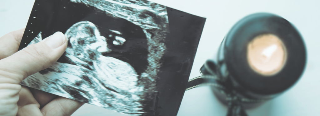 pregnancy loss resources image